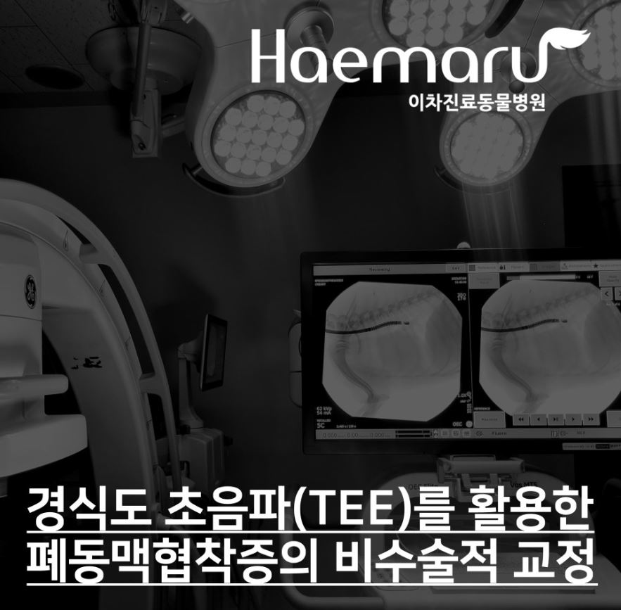 경식도 초음파(TEE)를 활용한 폐동맥 협착증의 비수술적 교정 썸네일