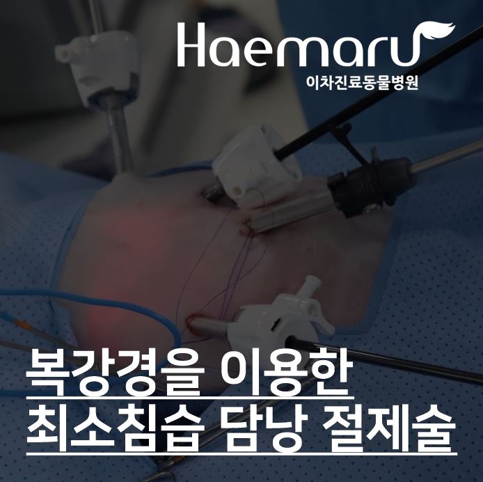 최신 복강경을 이용한 담낭 점액종 최소침습 담낭 절제술 썸네일