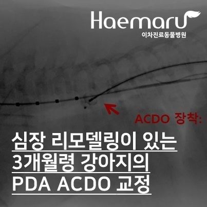 심장 리모델링이 있는 3개월령 강아지의 PDA 인터벤션 교정 썸네일