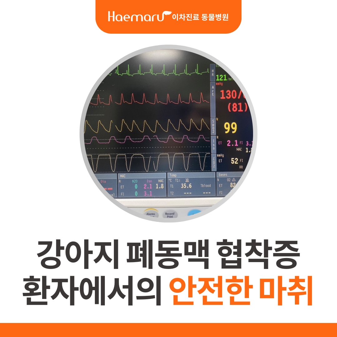 폐동맥 협착증 환자에서의 안전한 마취(해마루 마취통증의학과) 썸네일