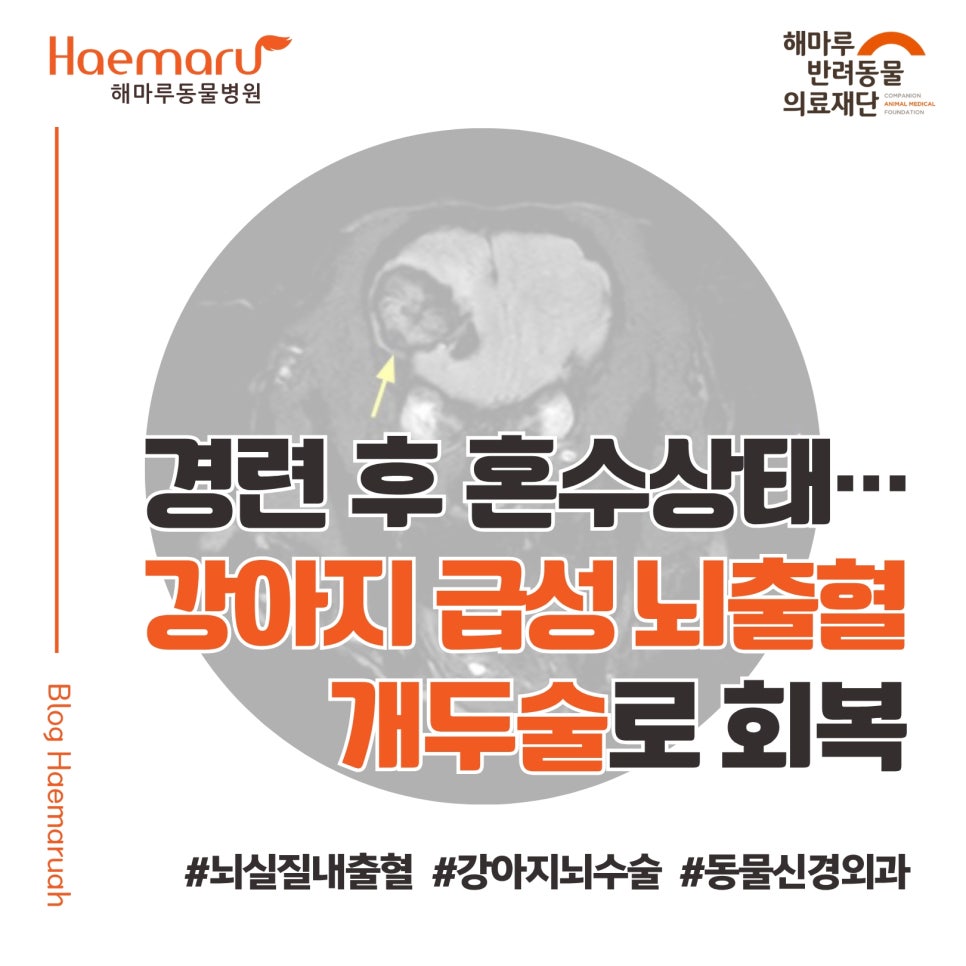 강아지 뇌수술) 첫 경련 후 혼수상태... 급성 뇌출혈 개두술로 회복한 사례 썸네일