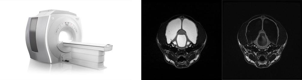 MRI 검사