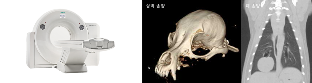 컴퓨터 단층 촬영(CT) 검사