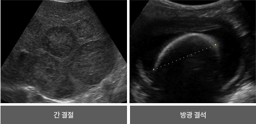 예시이미지